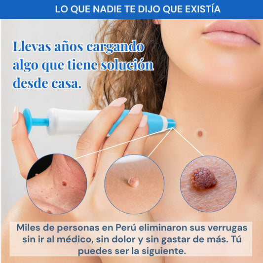 REMOVEDOR DE VERRUGAS